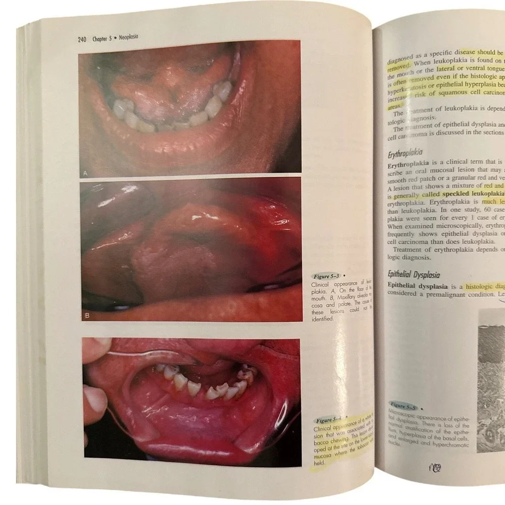 Oral Pathology for the Dental Hygienist Third Edition Textbook Ibsen Phelan